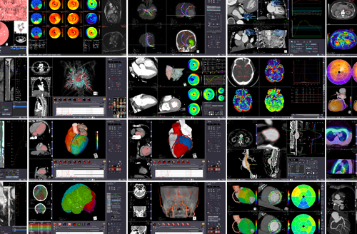 Ziostation2 Advanced visualization