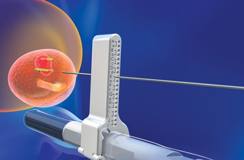 3D TRUS & MRI Guided Prostate Biopsy System