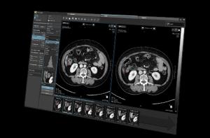 Tumour staging SW solution